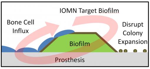 Bacterial assassins - Iron-oxide nanoparticles developed at Brown University target an infected prosthesis, penetrate a bacterial film on the implant’s surface and thwart the colony by killing the bacteria. The nanoparticles also are believed to help natural bone cell growth.